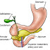 Anomalii pancreatice  congenitale 