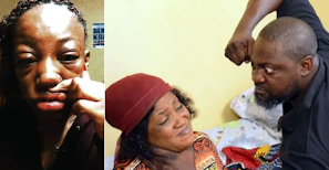 Man Angrily removes three teeth of his wife after finding out he's not the biological father of their 3 kids