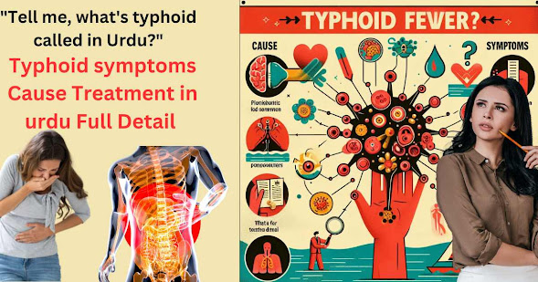 What is typhoid disease in Urdu?