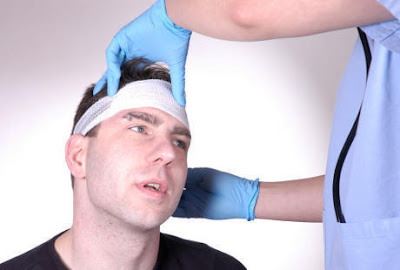 Penyebab dan Cara Mengatasi Cedera Kepala