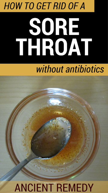 How To Get Rid Of A Sore Throat Without Antibiotics