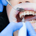 Affordable Dental Care: Strategies for Managing Costs and Maintaining Oral Health