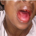 Woman’s Teeth Allegedly Knocked Out By Her Husband (Domestic Violence )