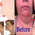 How to Get Rid of a Double Chin In 72 Hours