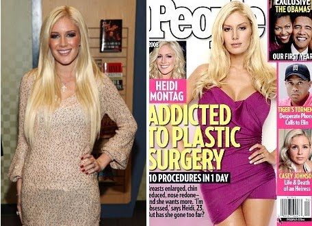 heidi montag before and after 10 surgeries. heidi montag before and after