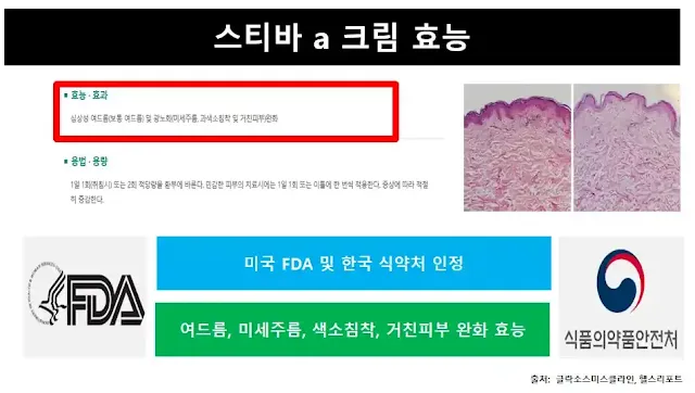 스티바a크림효능