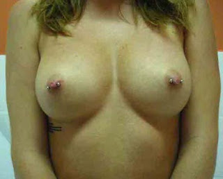 Female Nipple Piercing