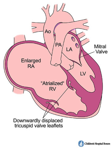 Mad About Pediatriccardiology