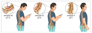 Cervical pain treatments, diagnosis and symptoms in children and adolescents