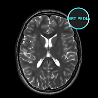 MRT PEDIA - МРТ головного мозга