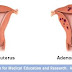 AYURVEDIC ENLARGED UTERUS (ADENOMYOSIS) REMEDIES