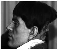 man with two faces; two faces; edward mordrake; edward; edward mordake; two faces; evil faces