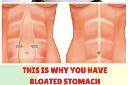 I Always Had a Swollen Stomach, Until I Learned About These Five Habits That Cause It…