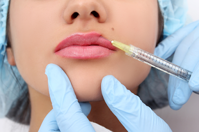 dermal fillers hamilton