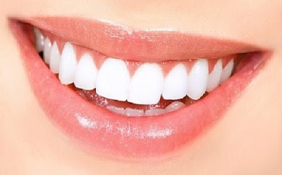 Bọc răng sứ nguyên hàm giá bao nhiêu?