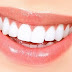 Chi phí bọc răng sứ nguyên hàm