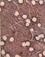 Bactéria causadora da Sífilis