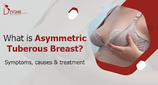 Tubular Breasts: Symptoms, Causes & Treatment