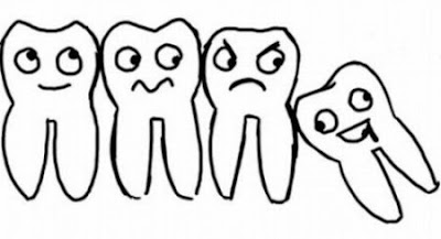Tác hại cần biết của răng khôn mọc lệch và mọc ngầm