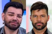 Eita! Homem faz mais de 30 cirurgias plásticas para ficar parecido com Ricky Martin