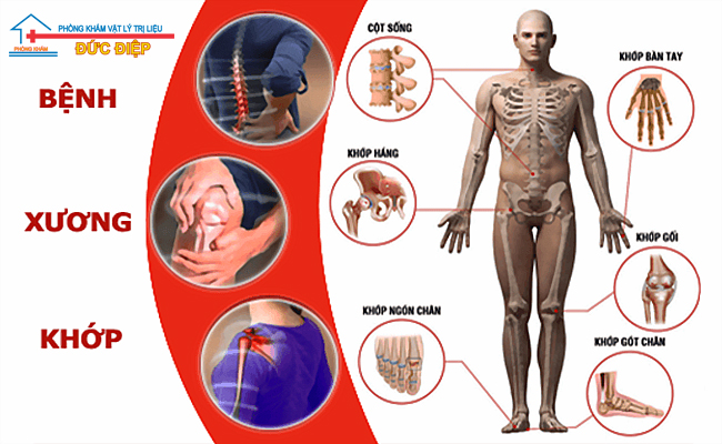 Tập Vật Lý Trị Liệu Xương Khớp, Chữa Xương Khớp Bằng Vật Lý Trị Liệu Tại Nhà