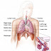 Typical Symptoms Of Mesothelioma