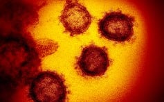 Variantes do SARSCOV-2 podem unir duas ou mais células humanas criando uma super fábrica de vírus