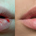 Remedies for Chapped lips