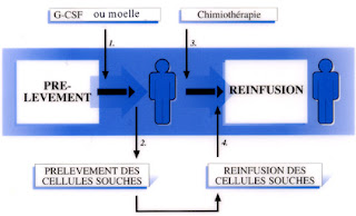 La greffe de moelle osseuse 