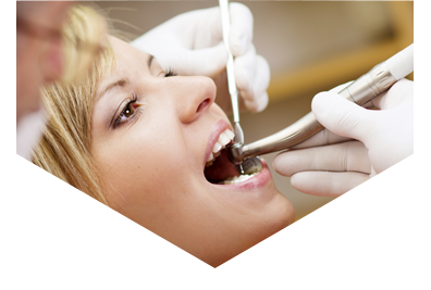 Dental Filling Preston