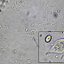 Trophozoite Of Giardia Lamblia In Stool