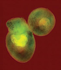 A pair of yeast cells imaged at very high resolution using coherent soft x-rays at the Advanced Light Source's beamline 9.0.1. The coherent (laser-like) beam of penetrating x-rays allows a computer to reconstruct the cells' internal structures from a diffraction pattern, without focusing the light with a lens. (Credit: Image courtesy of DOE/Lawrence Berkeley National Laboratory)