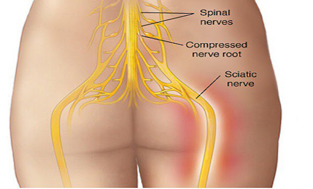 Successful In 95%, This Is The Natural Way Of Saying Goodbye To Back Pain