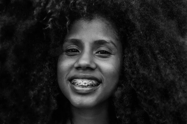 Avoid After Braces