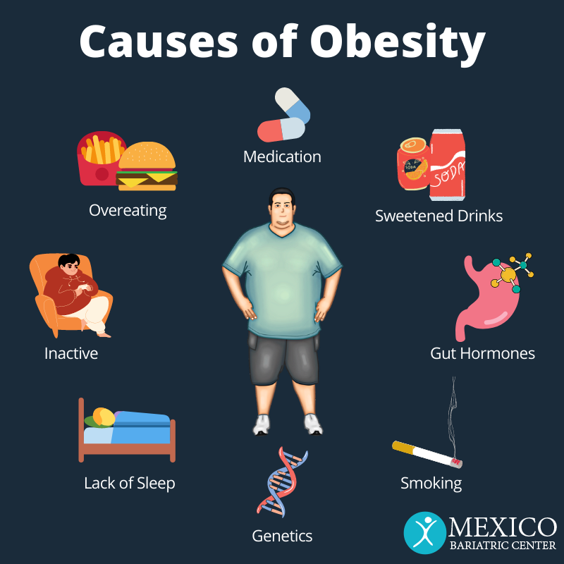 laziness is the main cause of obesity muet essay