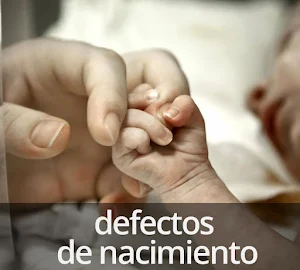 Defectos de nacimiento