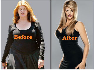 Kirstie Alley weight loss