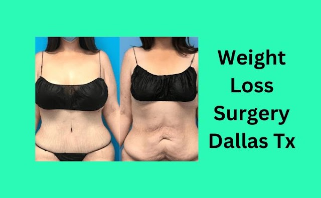 Weight Loss Surgery Dallas Tx : Transform Your Life