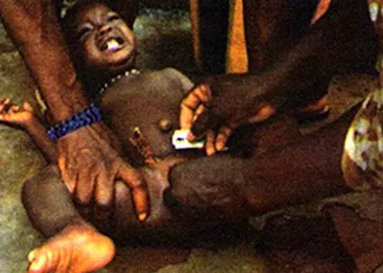 Female circumcision