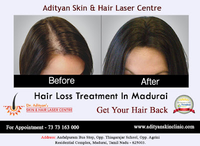 http://adityanskinclinic.com/