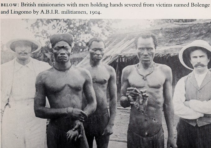 Congolese posing with the severed hands of those who failed to make the daily rubber sap quota 