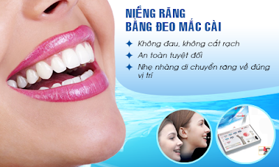 Tìm hiểu ưu điểm của niềng răng không mắc cài