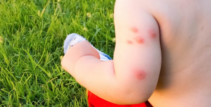 Seven simple ways to protect your baby from mosquito bites