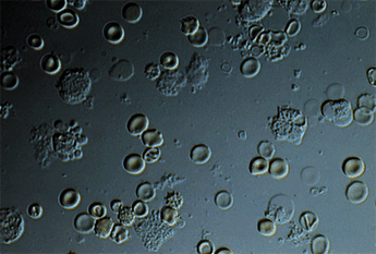 LAB PATOLOGI KLINIK Urinalysis sedimen 