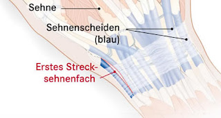   sehnenscheidenentzündung handgelenk, sehnenscheidenentzündung handgelenk symptome, sehnenscheide entzündet handgelenk hausmittel, sehnenscheide entzündet handgelenk op, sehnenscheide entzündet handgelenk krankschreibung, sehnenscheide entzündet handgelenk tape, sehnenscheidenentzündung handgelenk bandage, sehnenscheidenentzündung salbe, sehnenscheidenentzündung handgelenk schiene