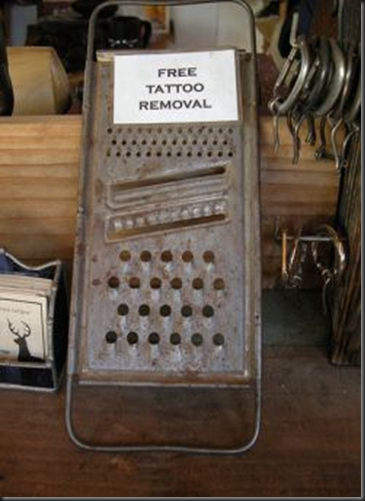 remoc-de-tatuagem