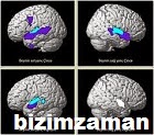 tip dilinde afazi anlami nedir afazi neye denir 1