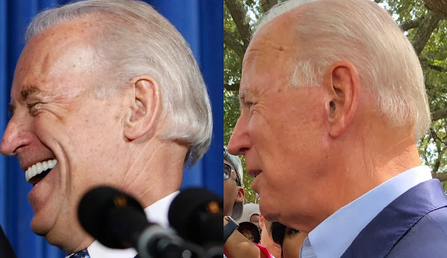 Joe Biden have plastic surgery on his face?