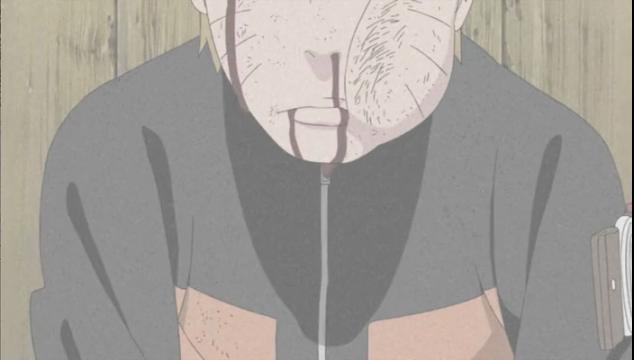 Assistir Naruto Shippuden 238 Legendado Online