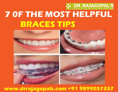 Braces Treatment in Gurgaon